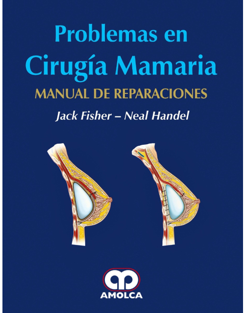 Problemas en Cirugía Mamaria. Manual de Reparaciones