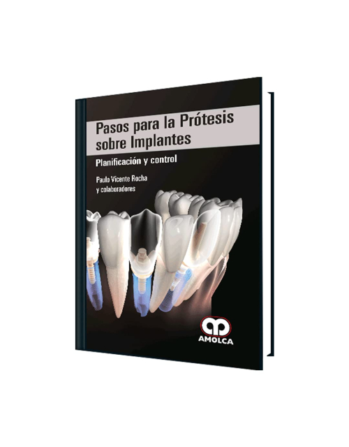 Pasos para la Prótesis sobre Implantes