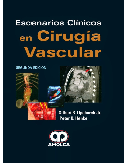 Escenarios Clínicos en Cirugía Vascular