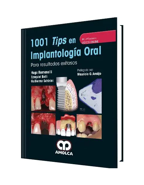 1001 Tips en Implantología Oral