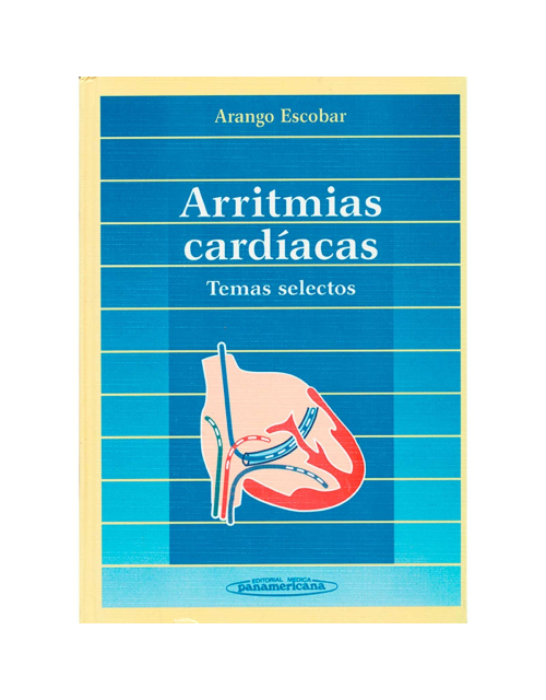 Arritmias Cardiacas