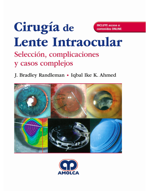 Cirugía de Lente Intraocular. Selección, Complicaciones y Casos Complejos