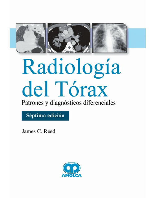 Radiología del Tórax