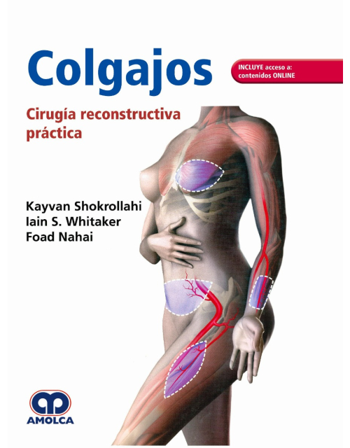 Colgajos. Cirugía Reconstructiva Práctica