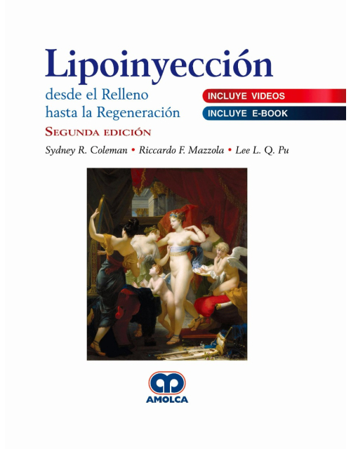 Lipoinyección desde el Relleno hasta la Regeneración