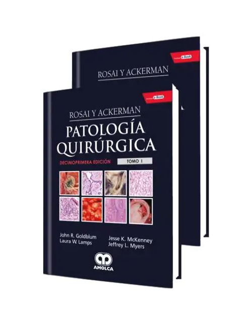 Rosai y Ackerman Patología Quirúrgica, 2 Vols.