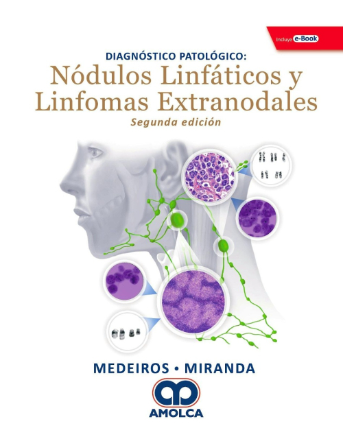 Diagnóstico Patológico. Nódulos Linfáticos y Linfomas Extranodales