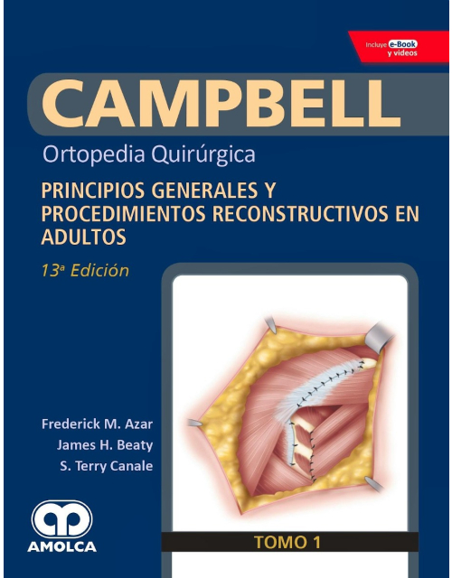 CAMPBELL Ortopedia Quirúrgica, Tomo 1: Principios Generales y Procedimientos Reconstructivos en Adultos