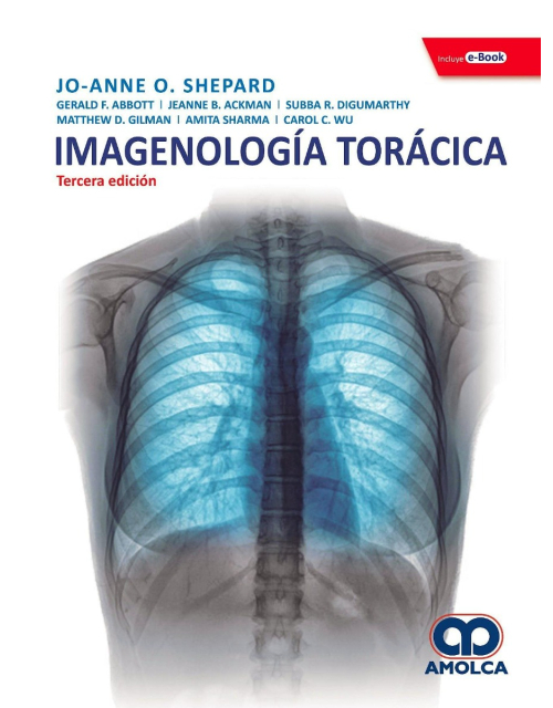 Imagenología Torácica