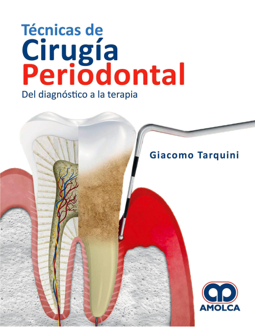 Técnicas de Cirugía Periodontal. Del Diagnóstico a la Terapia