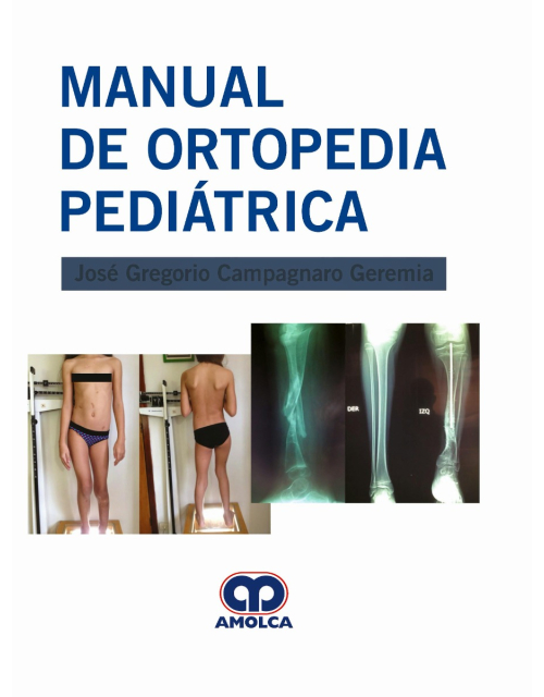 Manual de Ortopedia Pediátrica