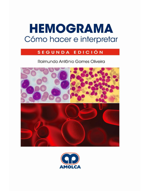 Hemograma. Cómo Hacer e Interpretar