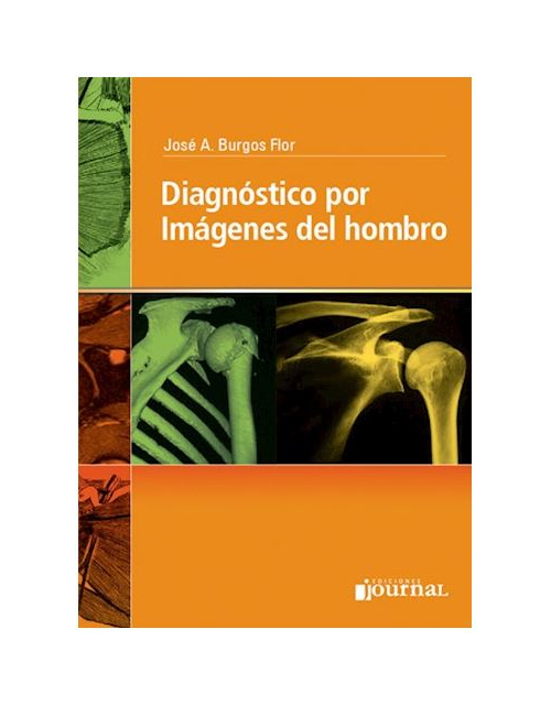 Diagnóstico Por Imágenes Del Hombro