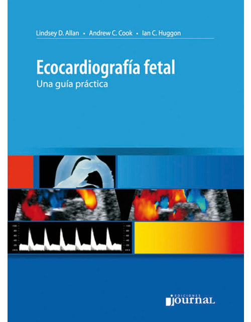 Ecocardiografía Fetal una guía practica