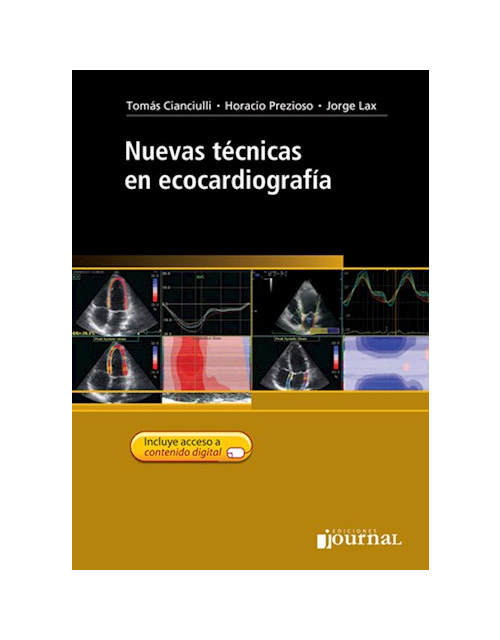 Nuevas Técnicas En Ecocardiografía