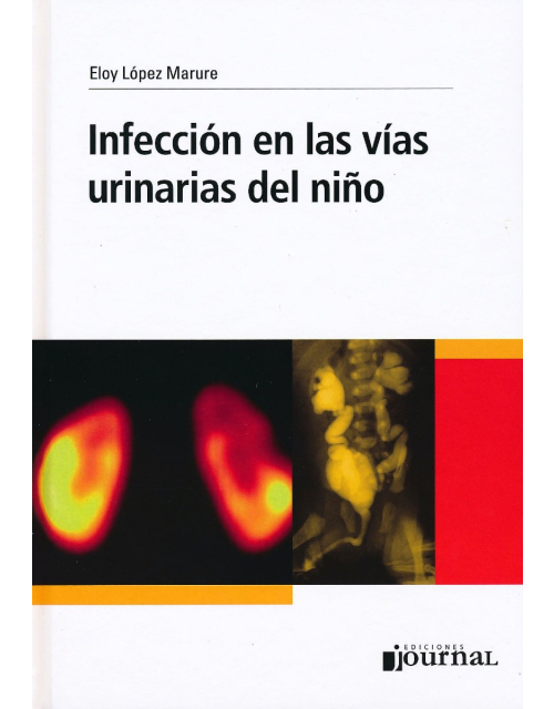 Infección En Las Vías Urinarias Del Niño