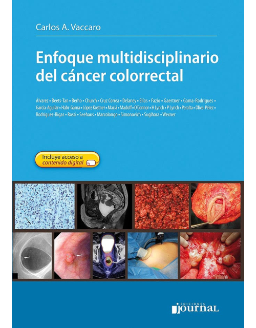 Enfoque Multidisciplinario Del Cáncer Colorrectal