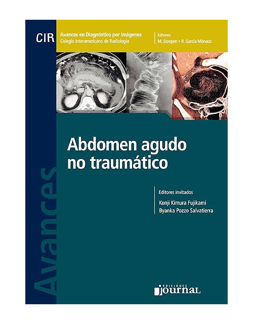 Avances En Diagnóstico Por Imágenes 13: Abdomen Agudo No Traumático