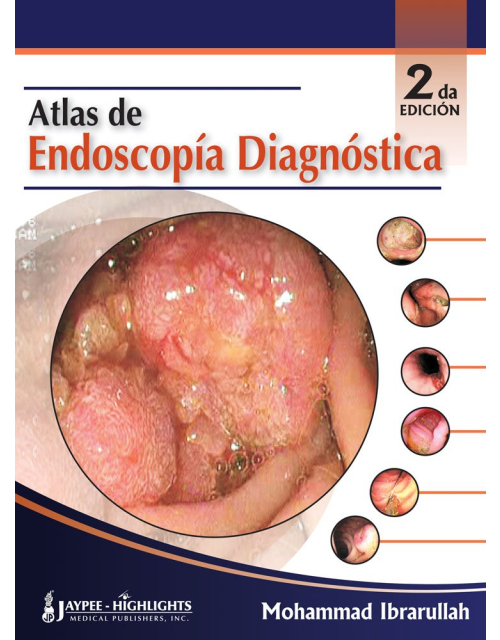 Atlas de Endoscopía Diagnóstica