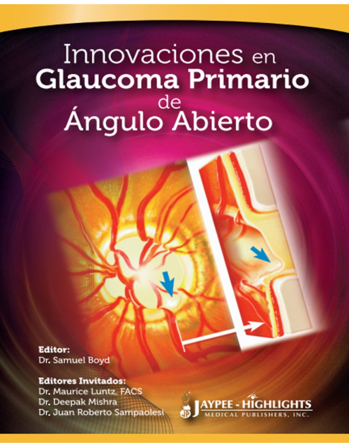 Innovaciones en Glaucoma Primario de Ángulo Abierto