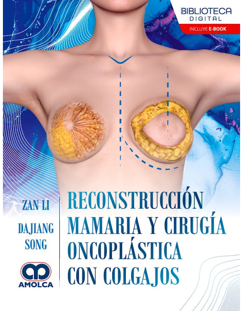 Reconstrucción Mamaria y Cirugía Oncoplástica con Colgajos