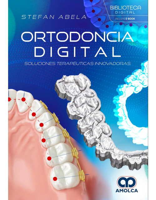Ortodoncia Digital. Soluciones Terapéuticas Innovadoras