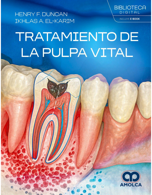 Tratamiento de la Pulpa Vital