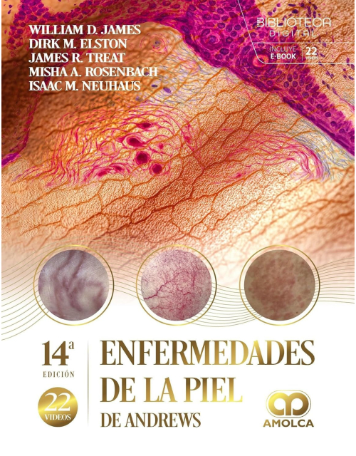 Enfermedades de la Piel de ANDREWS