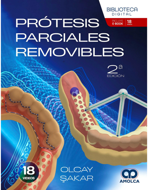 Prótesis Parciales Removibles