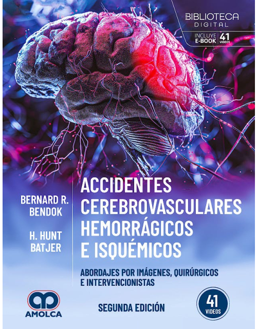 Accidentes Cerebrovasculares Hemorrágicos e Isquémicos.