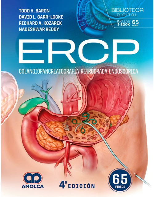 ERCP. Colangiopancreatografía Retrógrada Endoscópica