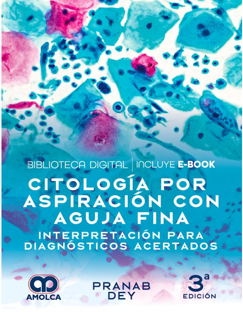 Citología por Aspiración con Aguja Fina. Interpretación para Diagnósticos Acertados