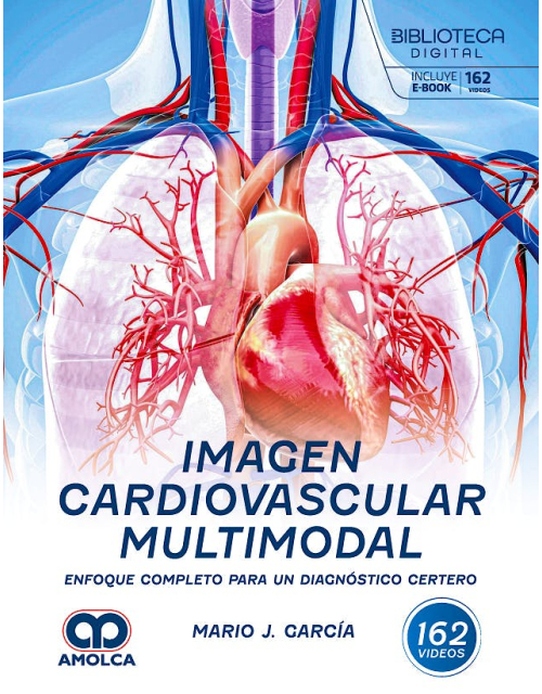 Imagen Cardiovascular Multimodal.