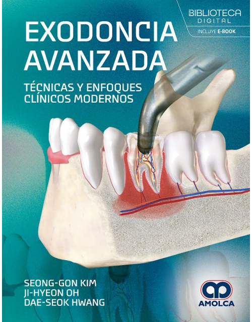 Exodoncia avanzada. Técnicas y enfoques clínicos modernos