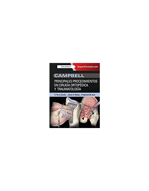 Campbell Principales Procedimientos En Cirugía Ortopédica Y Traumatología