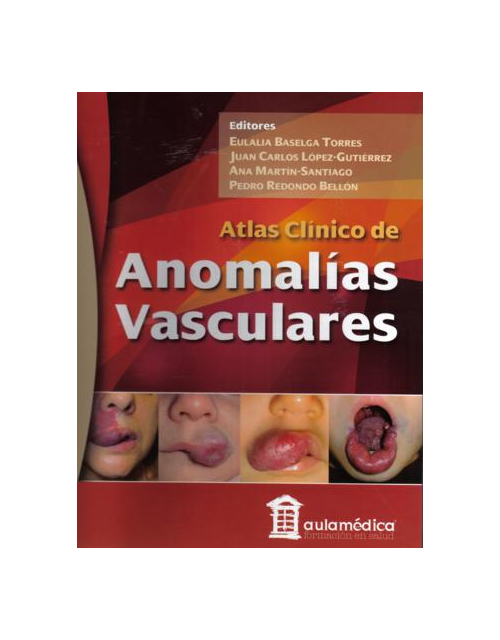 Atlas Clínico De Anomalías Vasculares