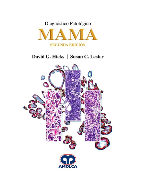 Diagnóstico Patológico. Mama