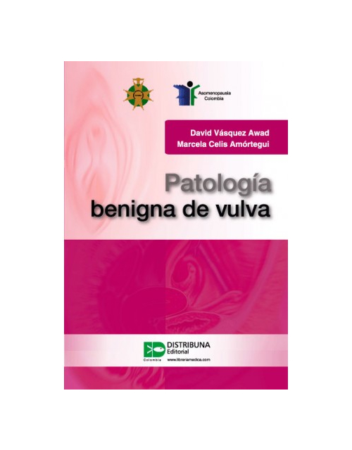 Patología Benigna De Vulva
