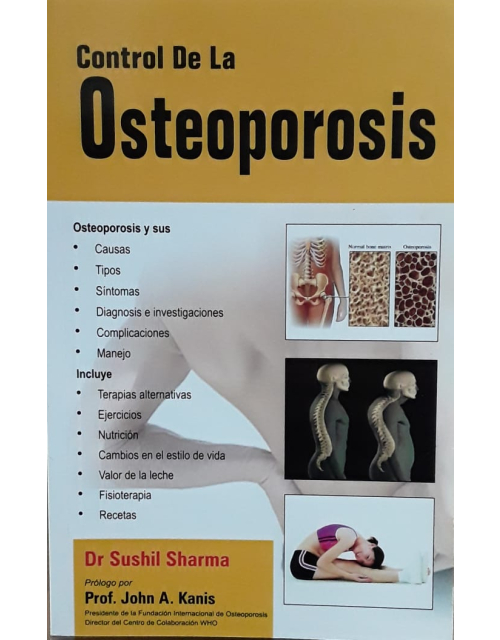 Control De La Osteoporosis