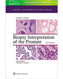 Biopsy Interpretation Of The Prostate 6Ed