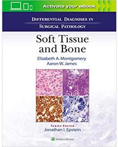 Differential Diagnoses In Surgical Pathology Soft Tissue And Bone