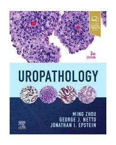  Uropathology, 2nd Edition
