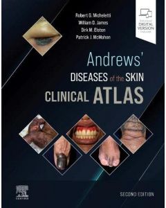 Andrews' Diseases Of The Skin Clinical Atlas,