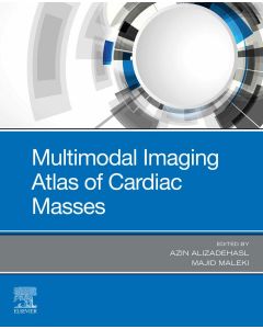 Multimodal Imaging Atlas Of Cardiac Masses, 1St Edition