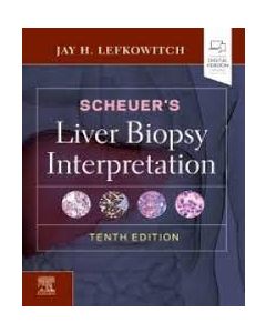 Scheuer'S Liver Biopsy Interpretation 10 Ed