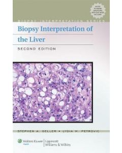 Biopsy Interpretation Of The Liver 2Ed