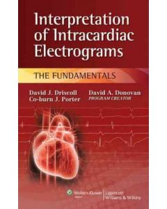 Interpretation of Intracardiac Electrograms