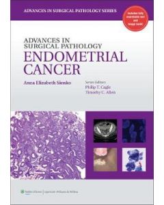 Advances In Surgical Pathology: Endometrial Carcinoma