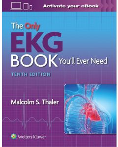 The Only Ekg Book You’Ll Ever Need