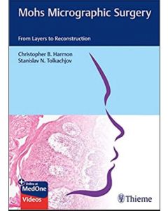 Mohs Micrographic Surgery: From Layers To Reconstruction 1St Edición